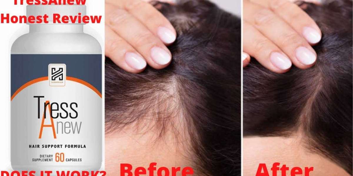 TressAnew Reviews ]Updated 2021] – Most Effective & Advanced Hair Loss Support Formula