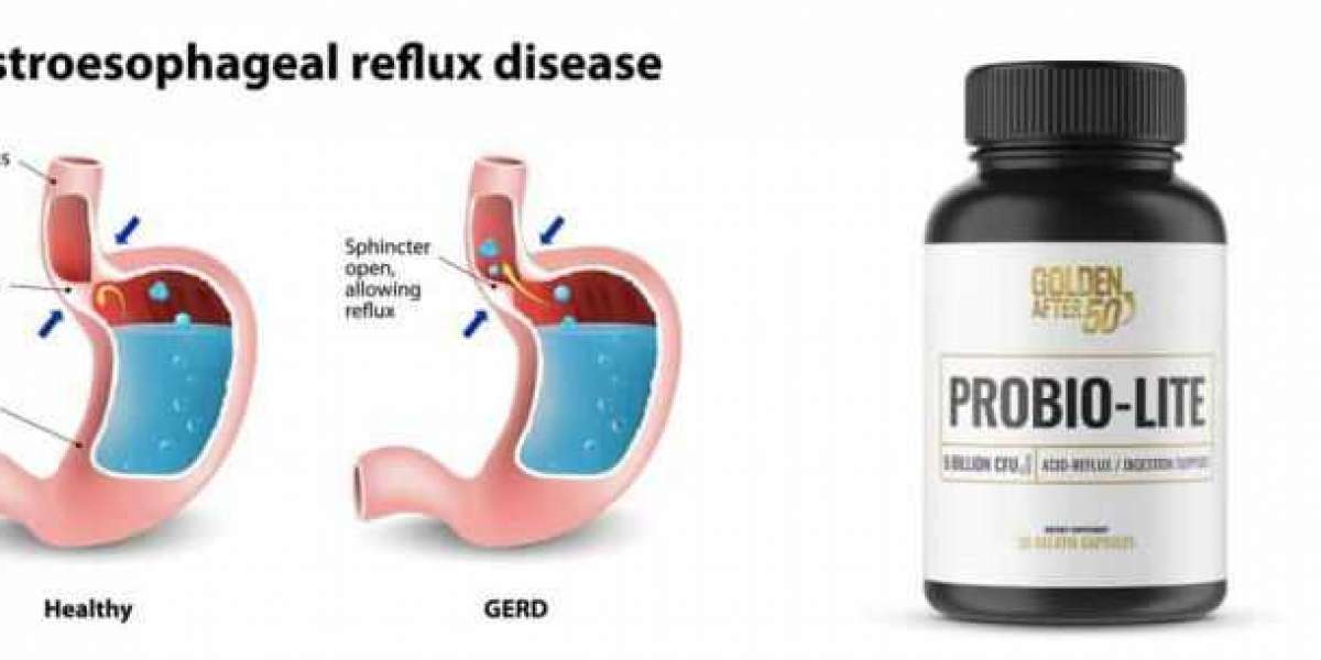 How Do You Cleanse Your Gut Probiolite Supplements?