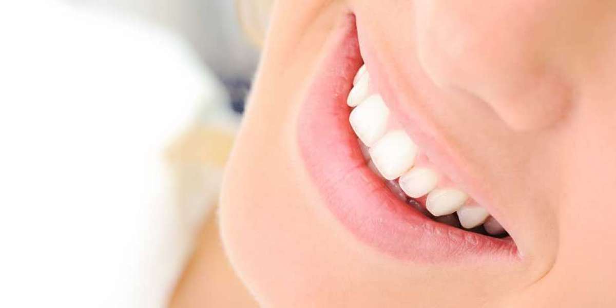 Whitening your teeth: the risks