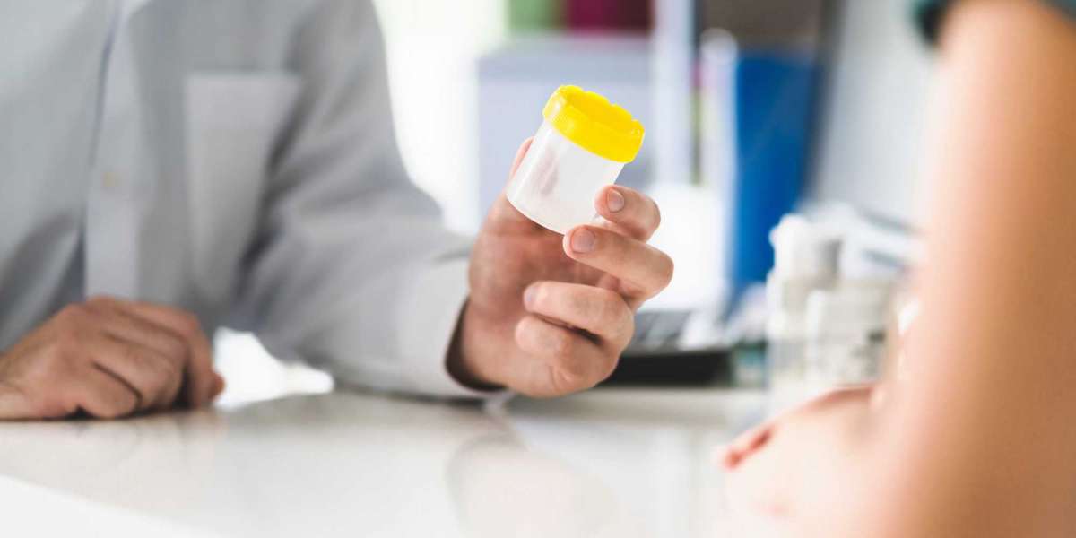5 Things You Should Learn About Drug Testing