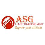ASG Transplant Profile Picture